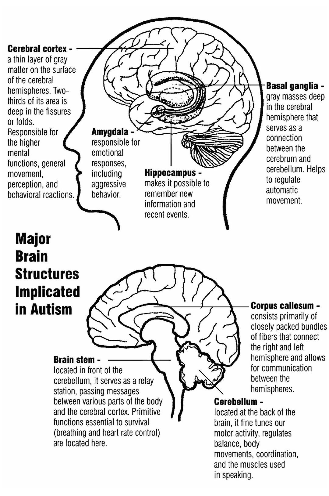 Classic autism - Wikipedia