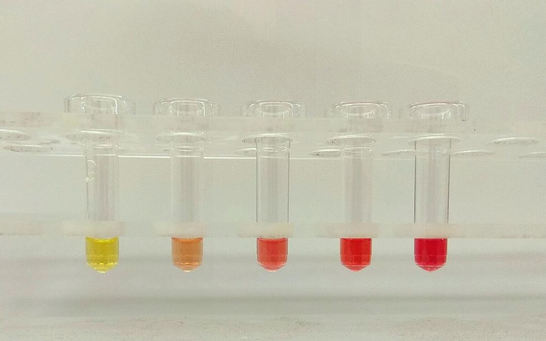 Hemolysis - Wikipedia