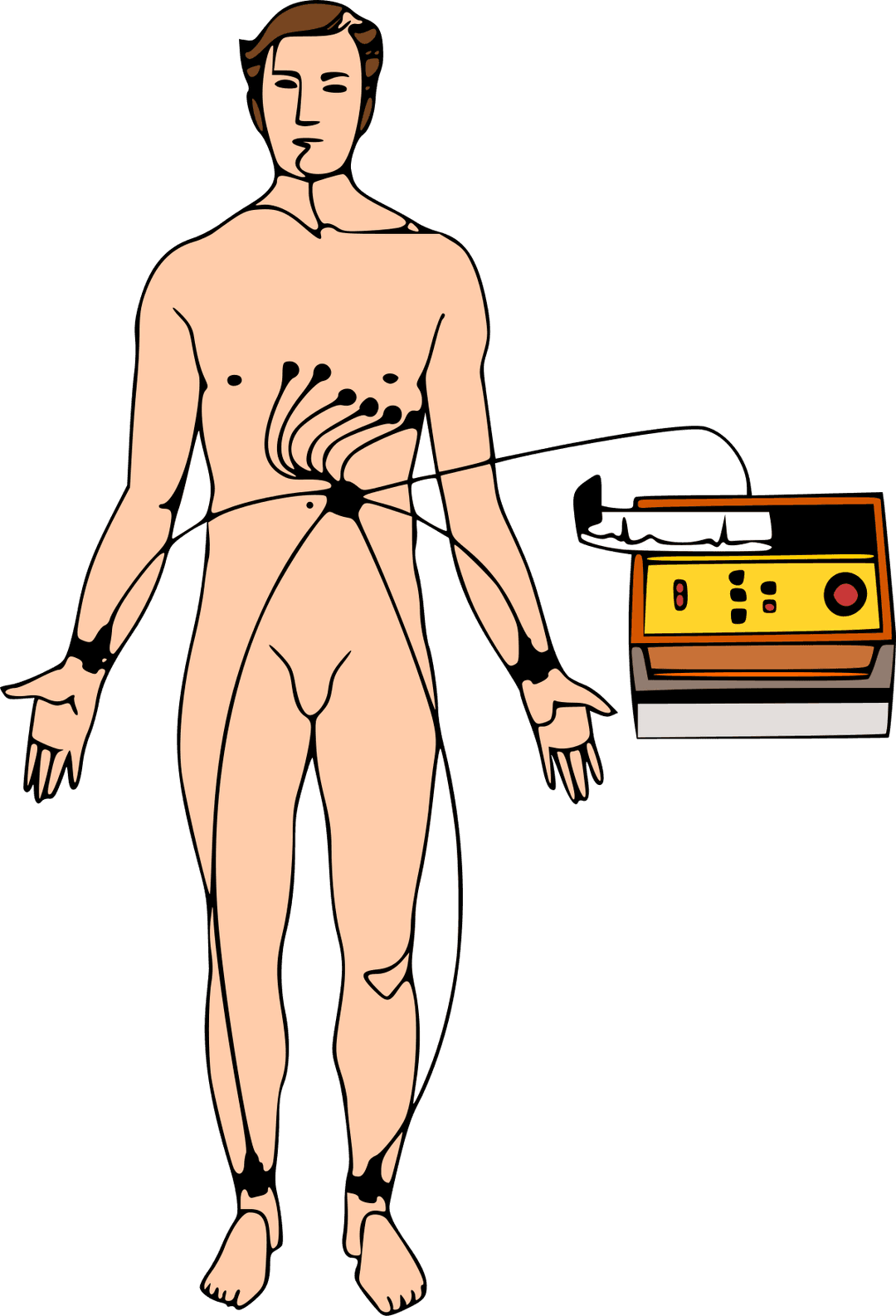 Électrocardiographie — Wikipédia