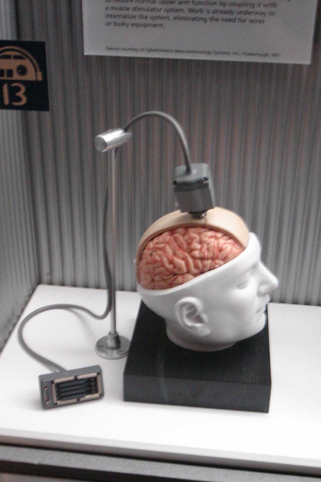 Brain–computer interface - Wikipedia